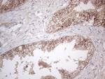 MCEE Antibody in Immunohistochemistry (Paraffin) (IHC (P))