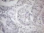 TDG Antibody in Immunohistochemistry (Paraffin) (IHC (P))