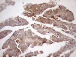 Aladin Antibody in Immunohistochemistry (Paraffin) (IHC (P))