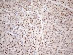 Aladin Antibody in Immunohistochemistry (Paraffin) (IHC (P))