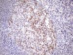 Aladin Antibody in Immunohistochemistry (Paraffin) (IHC (P))