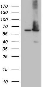 Aladin Antibody in Western Blot (WB)