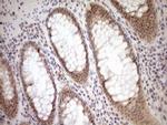 PARG Antibody in Immunohistochemistry (Paraffin) (IHC (P))