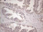 CNOT2 Antibody in Immunohistochemistry (Paraffin) (IHC (P))