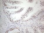 CNOT2 Antibody in Immunohistochemistry (Paraffin) (IHC (P))