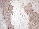 MRPL10 Antibody in Immunohistochemistry (Paraffin) (IHC (P))