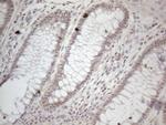 ZNF69 Antibody in Immunohistochemistry (Paraffin) (IHC (P))