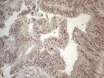 ZNF69 Antibody in Immunohistochemistry (Paraffin) (IHC (P))