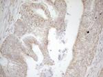 NAPSA Antibody in Immunohistochemistry (Paraffin) (IHC (P))