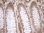 ASPDH Antibody in Immunohistochemistry (Paraffin) (IHC (P))