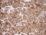 ASPDH Antibody in Immunohistochemistry (Paraffin) (IHC (P))