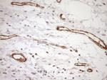 ASPDH Antibody in Immunohistochemistry (Paraffin) (IHC (P))