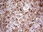 SHMT2 Antibody in Immunohistochemistry (Paraffin) (IHC (P))