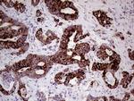 SHMT2 Antibody in Immunohistochemistry (Paraffin) (IHC (P))