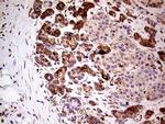 SHMT2 Antibody in Immunohistochemistry (Paraffin) (IHC (P))