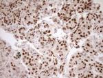 HOXC10 Antibody in Immunohistochemistry (Paraffin) (IHC (P))