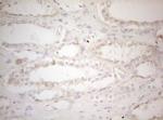 MAD4 Antibody in Immunohistochemistry (Paraffin) (IHC (P))