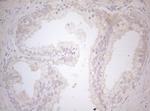 MAD4 Antibody in Immunohistochemistry (Paraffin) (IHC (P))