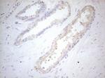 MAD4 Antibody in Immunohistochemistry (Paraffin) (IHC (P))