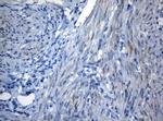 ZNF394 Antibody in Immunohistochemistry (Paraffin) (IHC (P))