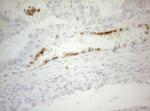 ZNF394 Antibody in Immunohistochemistry (Paraffin) (IHC (P))