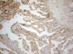 PTK9 Antibody in Immunohistochemistry (Paraffin) (IHC (P))