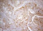 PTK9 Antibody in Immunohistochemistry (Paraffin) (IHC (P))