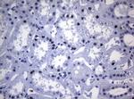 SAMD12 Antibody in Immunohistochemistry (Paraffin) (IHC (P))