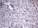 SAMD12 Antibody in Immunohistochemistry (Paraffin) (IHC (P))