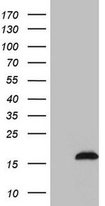 SAMD12 Antibody in Western Blot (WB)