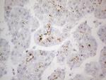 ZNF217 Antibody in Immunohistochemistry (Paraffin) (IHC (P))