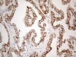 ZNF217 Antibody in Immunohistochemistry (Paraffin) (IHC (P))