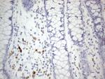 ZNF217 Antibody in Immunohistochemistry (Paraffin) (IHC (P))