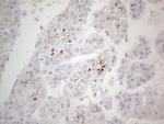 ZNF217 Antibody in Immunohistochemistry (Paraffin) (IHC (P))