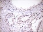 TCP10 Antibody in Immunohistochemistry (Paraffin) (IHC (P))