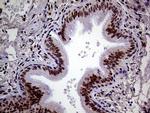 MAGEB4 Antibody in Immunohistochemistry (Paraffin) (IHC (P))