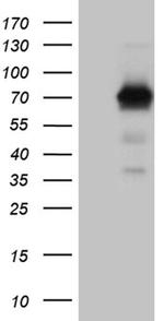 Intestinal Alkaline Phosphatase Antibody in Western Blot (WB)