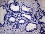 SSU72 Antibody in Immunohistochemistry (Paraffin) (IHC (P))