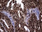 SSU72 Antibody in Immunohistochemistry (Paraffin) (IHC (P))