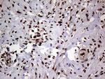 SSU72 Antibody in Immunohistochemistry (Paraffin) (IHC (P))