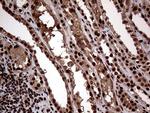 SSU72 Antibody in Immunohistochemistry (Paraffin) (IHC (P))