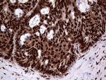 SSU72 Antibody in Immunohistochemistry (Paraffin) (IHC (P))