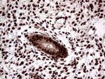 SSU72 Antibody in Immunohistochemistry (Paraffin) (IHC (P))