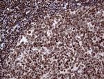 SSU72 Antibody in Immunohistochemistry (Paraffin) (IHC (P))