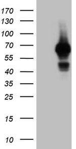 GRB7 Antibody in Western Blot (WB)