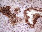 GNAS Antibody in Immunohistochemistry (Paraffin) (IHC (P))