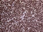 TRMT5 Antibody in Immunohistochemistry (Paraffin) (IHC (P))