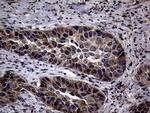 PITPNB Antibody in Immunohistochemistry (Paraffin) (IHC (P))