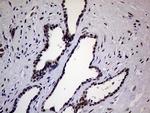 XPB Antibody in Immunohistochemistry (Paraffin) (IHC (P))