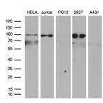 XPB Antibody in Western Blot (WB)